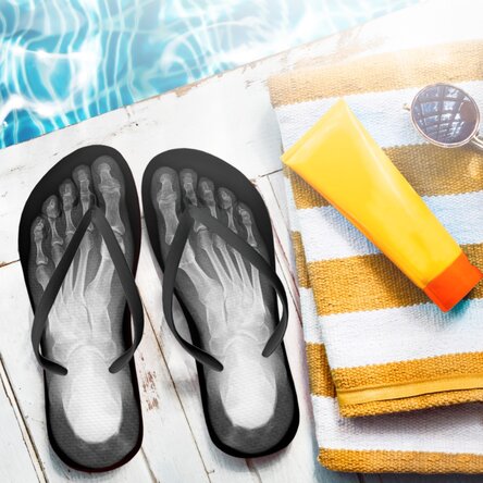 Flip-flops - X-Rays